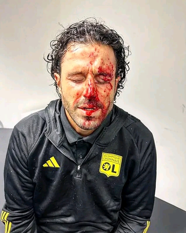 Olmpique Lyon Meminta Stadion Dipindahkan Dari Rasis Penggemar berdarah