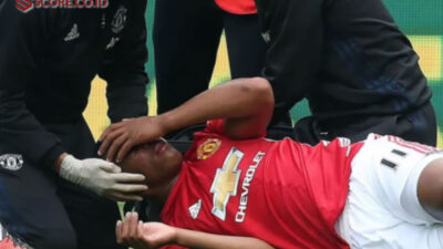 Dua Pemainnya Cedera Manchester United Masuk Masa Krisis
