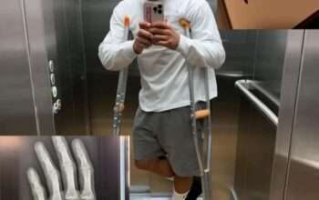 Meski Operasi Sukses, Jorge Martin Cedera Panjang, Siapa Penggantinya?