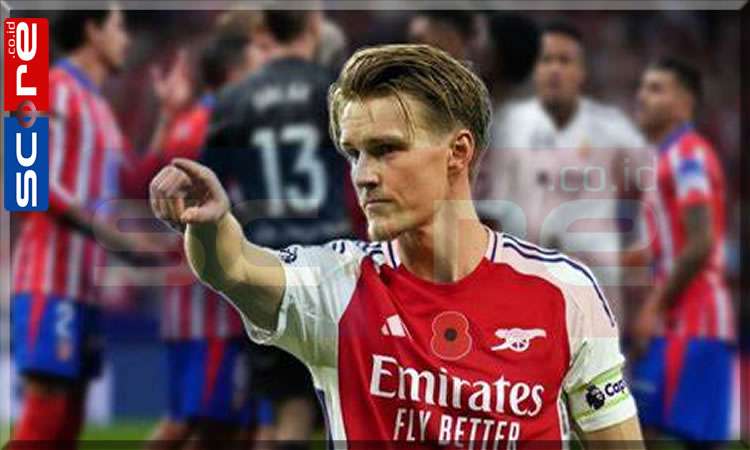 Andalkan Odegaard dalam Duel Kontra Manchester United